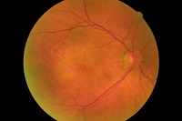 OCT Medoptica